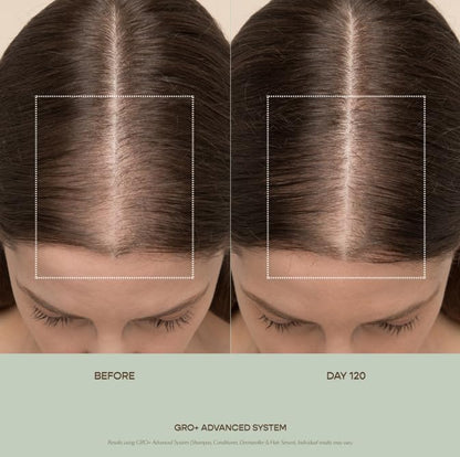 GRO+ Advanced Hair Serum